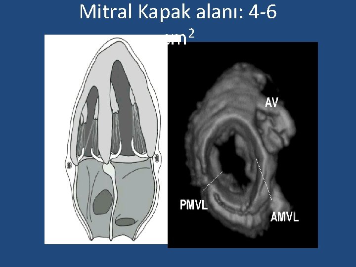 Mitral Kapak alanı: 4 -6 cm 2 