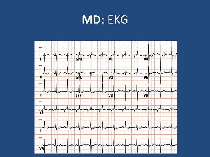 MD: EKG 