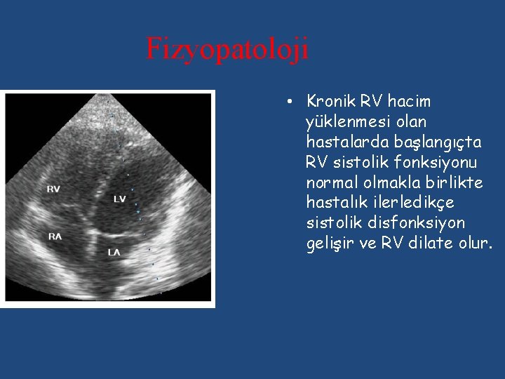 Fizyopatoloji • Kronik RV hacim yüklenmesi olan hastalarda başlangıçta RV sistolik fonksiyonu normal olmakla