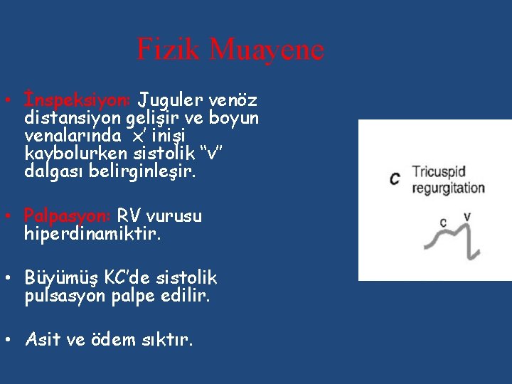 Fizik Muayene • İnspeksiyon: Juguler venöz distansiyon gelişir ve boyun venalarında x’ inişi kaybolurken