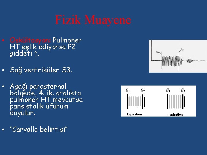 Fizik Muayene • Oskültasyon: Pulmoner HT eşlik ediyorsa P 2 şiddeti ↑. • Sağ