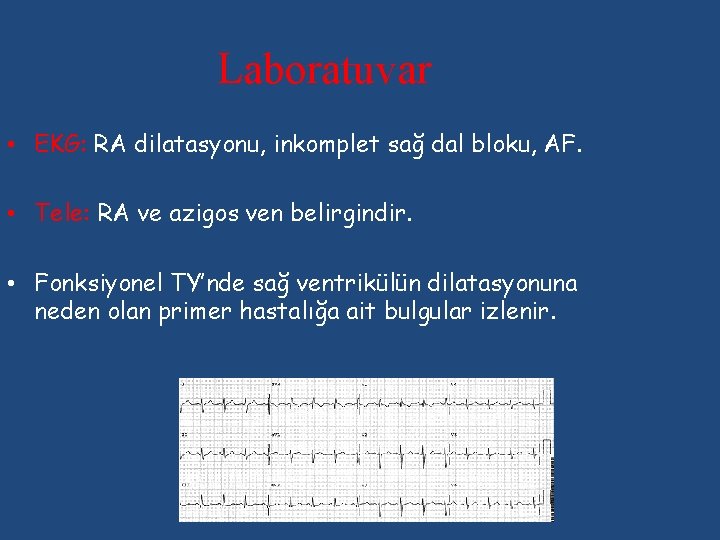 Laboratuvar • EKG: RA dilatasyonu, inkomplet sağ dal bloku, AF. • Tele: RA ve