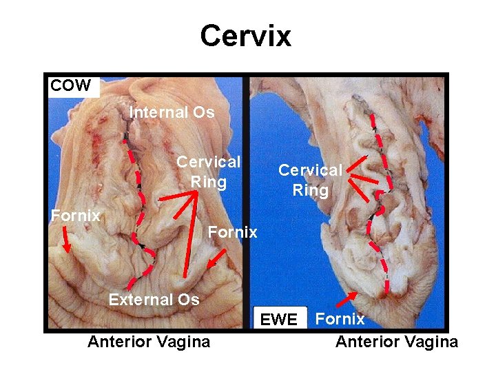Cervix COW Internal Os Cervical Ring Fornix External Os EWE Anterior Vagina Fornix Anterior