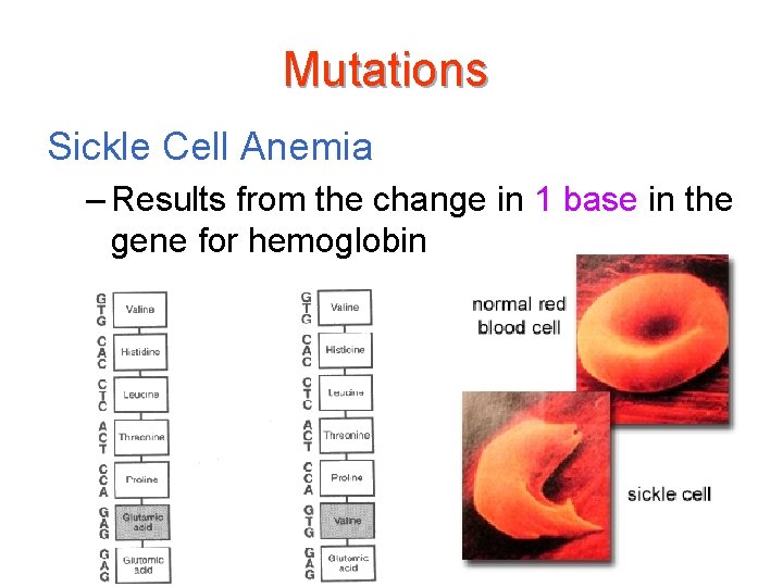 Mutations Sickle Cell Anemia – Results from the change in 1 base in the