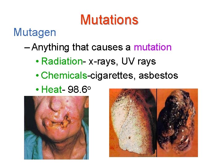 Mutagen Mutations – Anything that causes a mutation • Radiation- x-rays, UV rays •