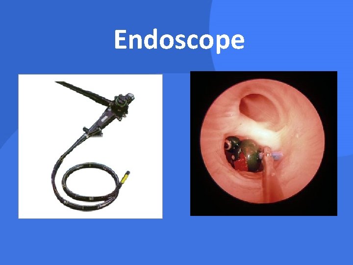 Endoscope 