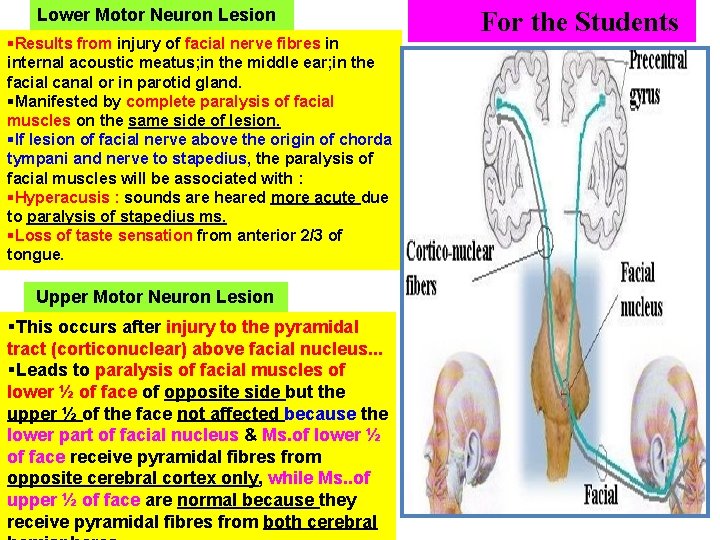 Lower Motor Neuron Lesion §Results from injury of facial nerve fibres in internal acoustic