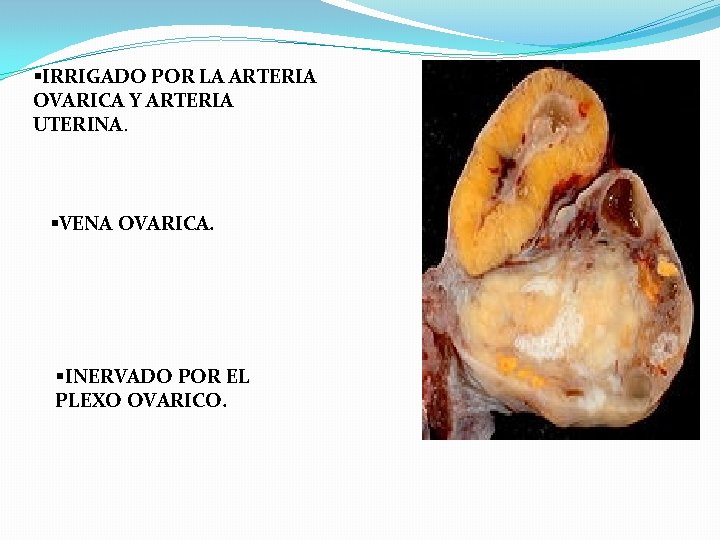 §IRRIGADO POR LA ARTERIA OVARICA Y ARTERIA UTERINA. §VENA OVARICA. §INERVADO POR EL PLEXO