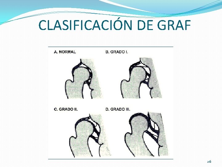CLASIFICACIÓN DE GRAF 26 CLASIFICACIÓN DE GRAF 26