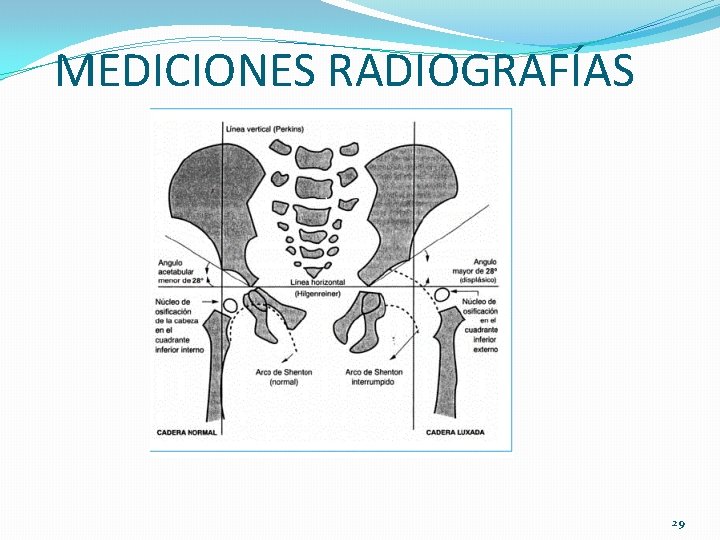 MEDICIONES RADIOGRAFÍAS 29 MEDICIONES RADIOGRAFÍAS 29