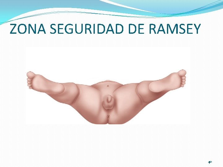 ZONA SEGURIDAD DE RAMSEY 40 ZONA SEGURIDAD DE RAMSEY 40