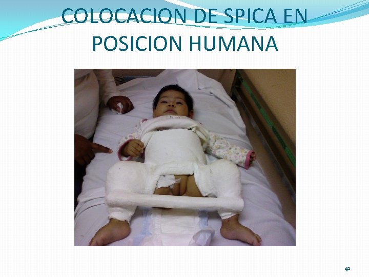 COLOCACION DE SPICA EN POSICION HUMANA 42 COLOCACION DE SPICA EN POSICION HUMANA 42