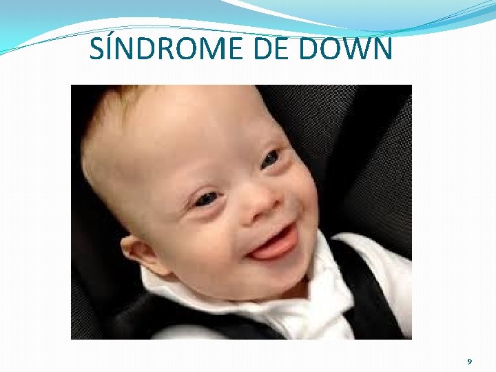 SÍNDROME DE DOWN 9 SÍNDROME DE DOWN 9