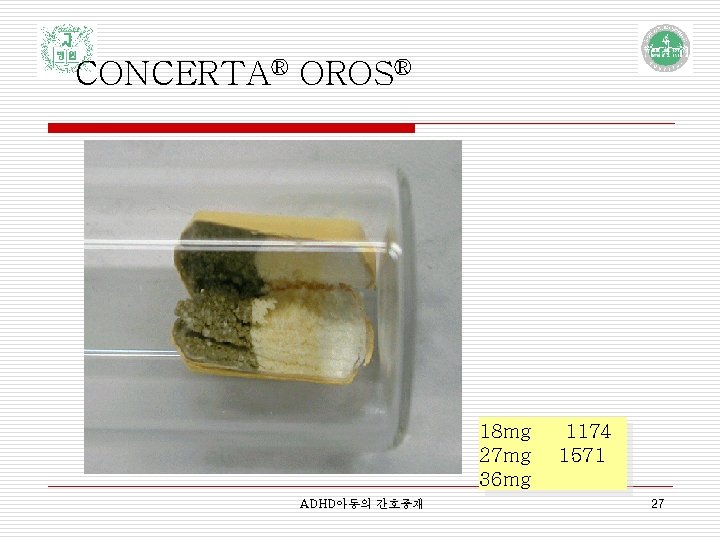 CONCERTA® OROS® 18 mg 27 mg 36 mg ADHD아동의 간호중재 1174 1571 27 