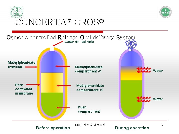 CONCERTA® OROS® Osmotic controlled Release Oral delivery System Laser-drilled hole Methylphenidate overcoat Methylphenidate compartment