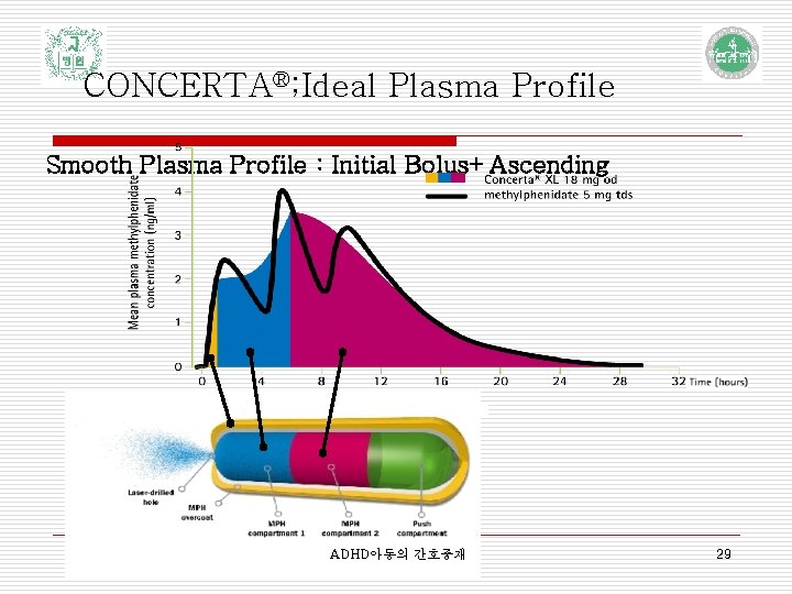CONCERTA®; Ideal Plasma Profile Smooth Plasma Profile : Initial Bolus+Ascending ADHD아동의 간호중재 29 