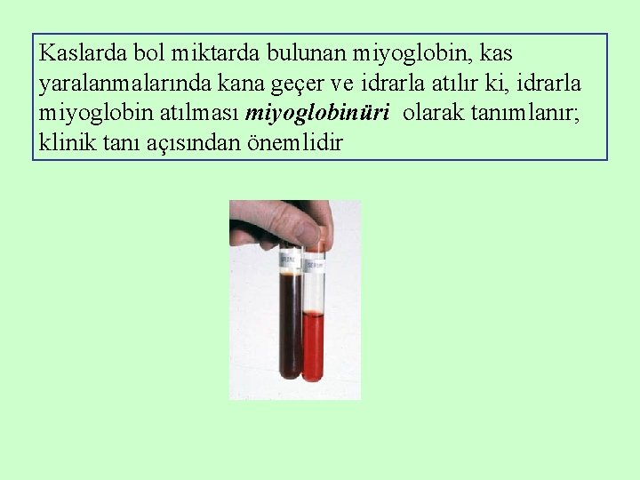 Kaslarda bol miktarda bulunan miyoglobin, kas yaralanmalarında kana geçer ve idrarla atılır ki, idrarla Kaslarda bol miktarda bulunan miyoglobin, kas yaralanmalarında kana geçer ve idrarla atılır ki, idrarla