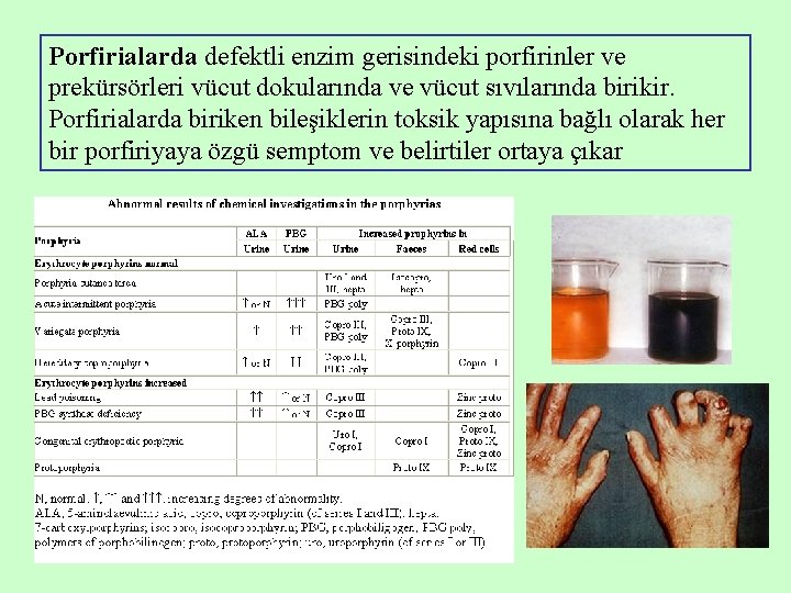 Porfirialarda defektli enzim gerisindeki porfirinler ve prekürsörleri vücut dokularında ve vücut sıvılarında birikir. Porfirialarda Porfirialarda defektli enzim gerisindeki porfirinler ve prekürsörleri vücut dokularında ve vücut sıvılarında birikir. Porfirialarda