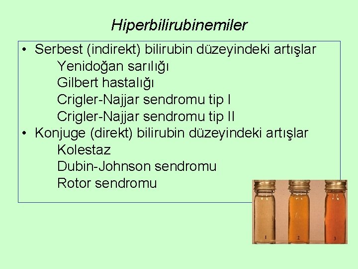 Hiperbilirubinemiler • Serbest (indirekt) bilirubin düzeyindeki artışlar Yenidoğan sarılığı Gilbert hastalığı Crigler-Najjar sendromu tip Hiperbilirubinemiler • Serbest (indirekt) bilirubin düzeyindeki artışlar Yenidoğan sarılığı Gilbert hastalığı Crigler-Najjar sendromu tip