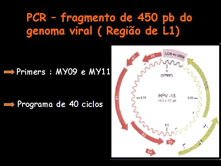 PCR – fragmento de 450 pb do genoma viral ( Região de L 1)