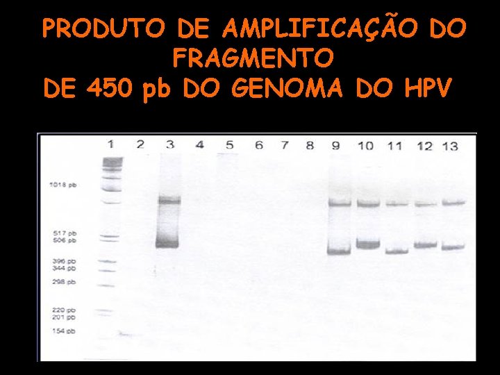 PRODUTO DE AMPLIFICAÇÃO DO FRAGMENTO DE 450 pb DO GENOMA DO HPV 