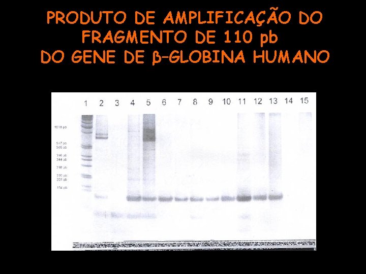 PRODUTO DE AMPLIFICAÇÃO DO FRAGMENTO DE 110 pb DO GENE DE β–GLOBINA HUMANO 
