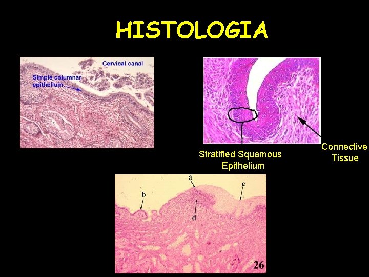 HISTOLOGIA Stratified Squamous Epithelium Connective Tissue 