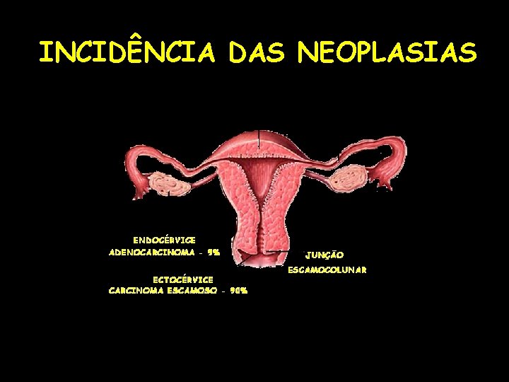 INCIDÊNCIA DAS NEOPLASIAS 