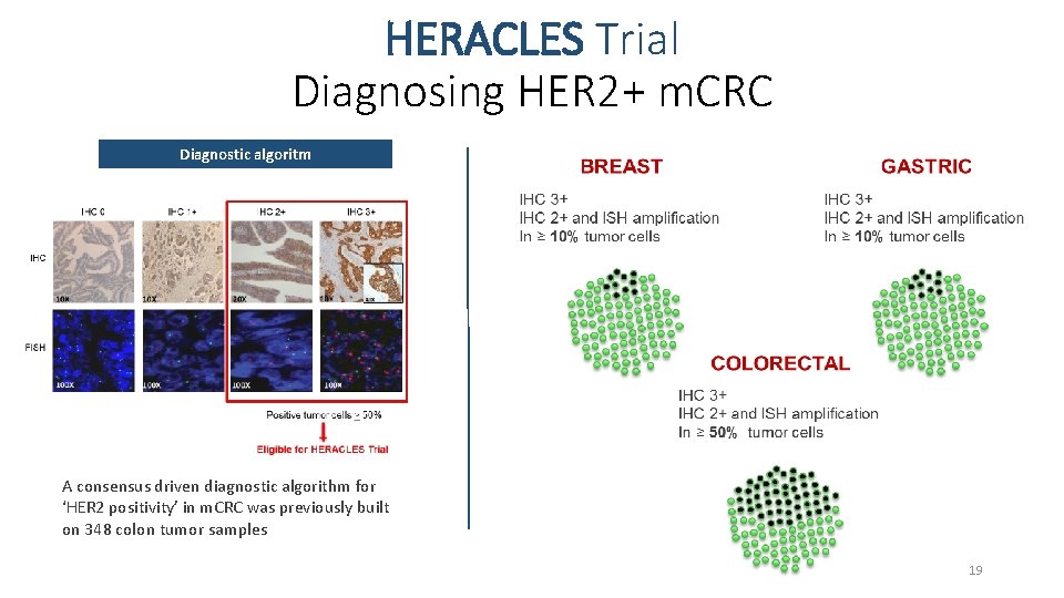 HERACLES Trial Diagnosing HER 2+ m. CRC Diagnostic algoritm A consensus driven diagnostic algorithm