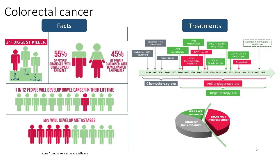 Colorectal cancer Facts Treatments 2 ND BIGGEST KILLER 2 BOWEL 1 LUNG 3 PROSTATE