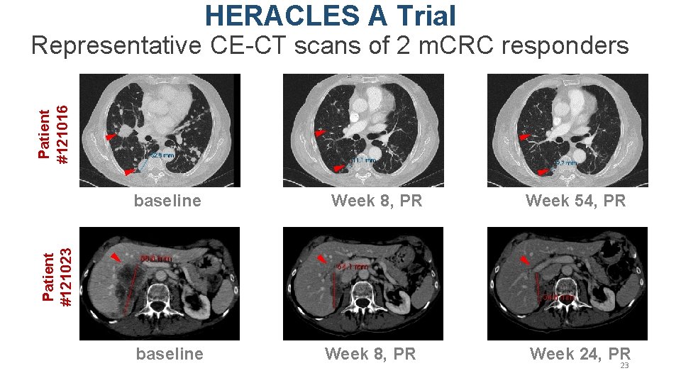 HERACLES A Trial Patient #121016 Representative CE-CT scans of 2 m. CRC responders Week