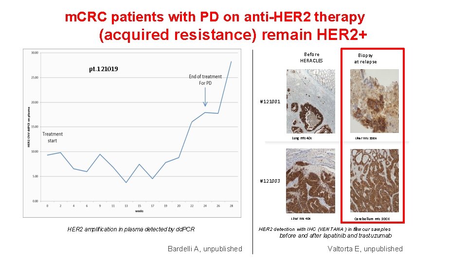 m. CRC patients with PD on anti-HER 2 therapy (acquired resistance) remain HER 2+