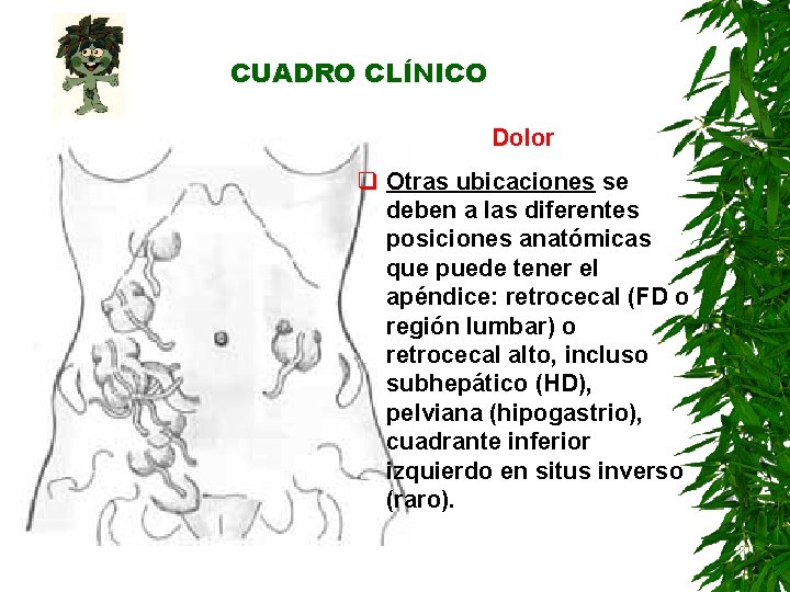 CUADRO CLÍNICO Dolor q Otras ubicaciones se deben a las diferentes posiciones anatómicas que CUADRO CLÍNICO Dolor q Otras ubicaciones se deben a las diferentes posiciones anatómicas que