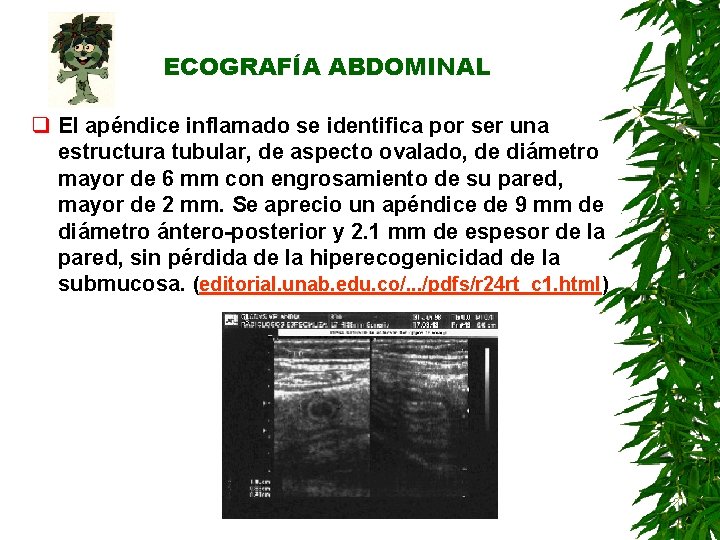 ECOGRAFÍA ABDOMINAL q El apéndice inflamado se identifica por ser una estructura tubular, de ECOGRAFÍA ABDOMINAL q El apéndice inflamado se identifica por ser una estructura tubular, de