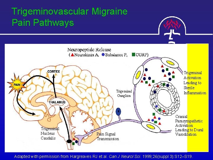 Trigeminovascular Migraine Pain Pathways Trigeminal Ganglion Trigeminal Nucleus Caudalis Pain Signal Transmission Trigeminal Activation