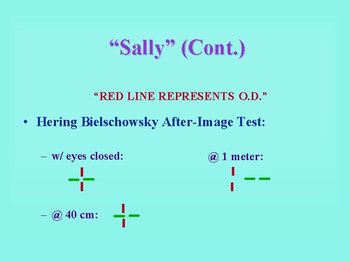 “Sally” (Cont. ) “RED LINE REPRESENTS O. D. ” • Hering Bielschowsky After-Image Test: