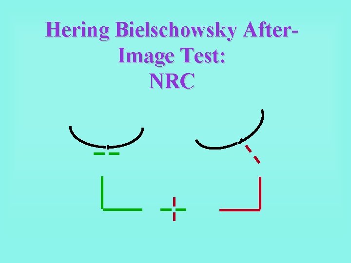 Hering Bielschowsky After. Image Test: NRC 