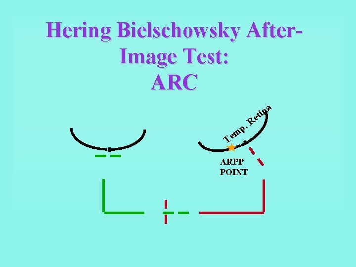 Hering Bielschowsky After. Image Test: ARC p. m Te ARPP POINT R n i