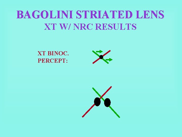 BAGOLINI STRIATED LENS XT W/ NRC RESULTS XT BINOC. PERCEPT: 