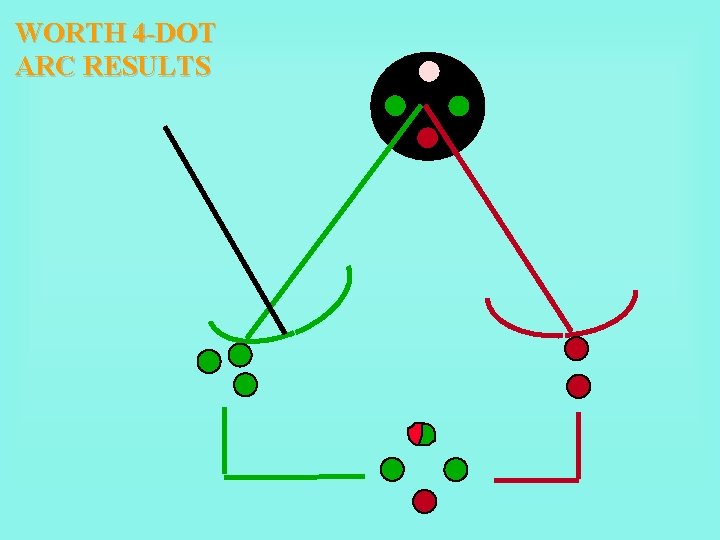 WORTH 4 -DOT ARC RESULTS 