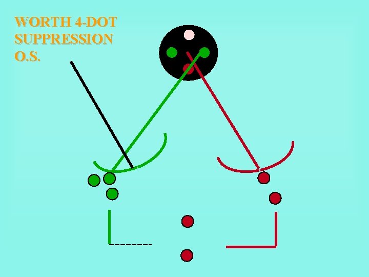 WORTH 4 -DOT SUPPRESSION O. S. 