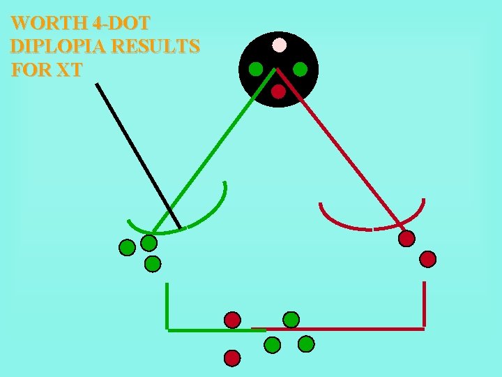 WORTH 4 -DOT DIPLOPIA RESULTS FOR XT 