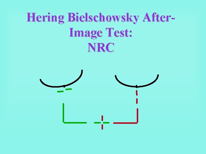 Hering Bielschowsky After. Image Test: NRC 