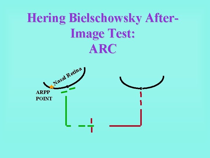 Hering Bielschowsky After. Image Test: ARC a l a s Na ARPP POINT R