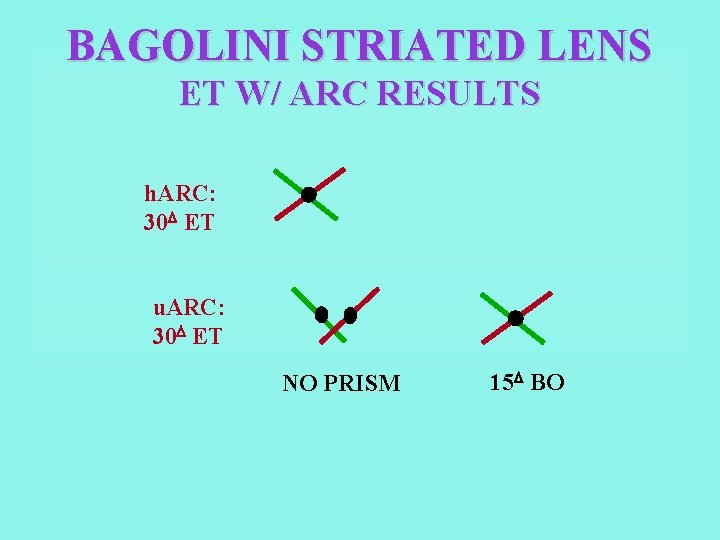 BAGOLINI STRIATED LENS ET W/ ARC RESULTS h. ARC: 30 ET u. ARC: 30