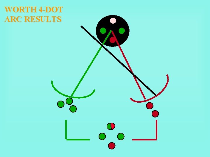 WORTH 4 -DOT ARC RESULTS 