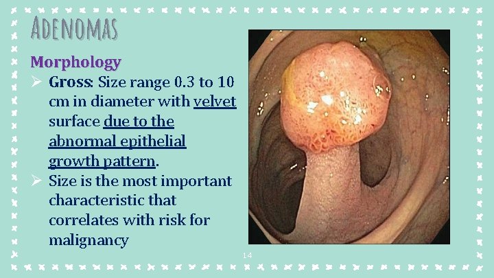 Adenomas Morphology Ø Gross: Size range 0. 3 to 10 cm in diameter with Adenomas Morphology Ø Gross: Size range 0. 3 to 10 cm in diameter with