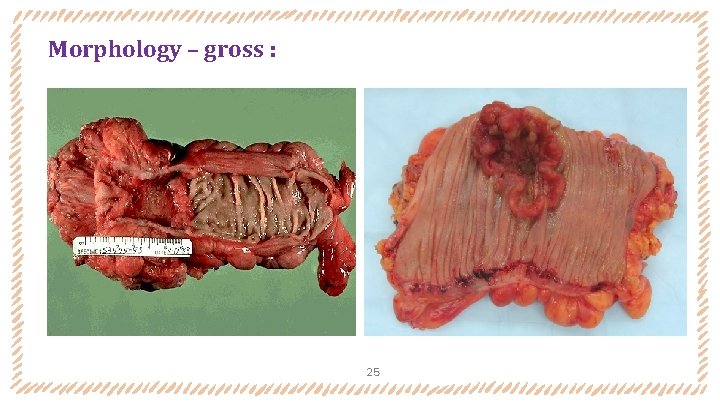 Morphology – gross : 25 Morphology – gross : 25
