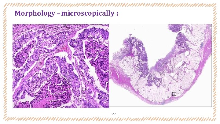 Morphology – microscopically : 27 Morphology – microscopically : 27