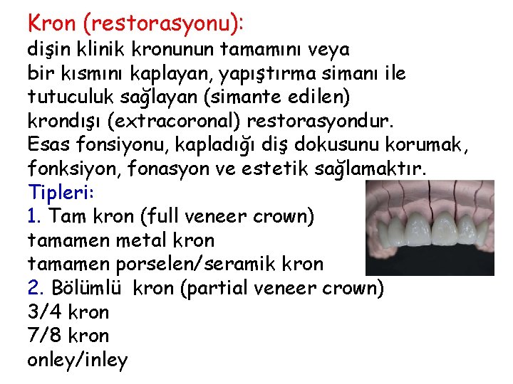 Kron (restorasyonu): dişin klinik kronunun tamamını veya bir kısmını kaplayan, yapıştırma simanı ile tutuculuk Kron (restorasyonu): dişin klinik kronunun tamamını veya bir kısmını kaplayan, yapıştırma simanı ile tutuculuk